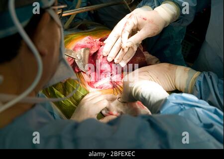 Chirurgen, die eine Lebertransplantation im Samsung Medical Center, Seoul, Südkorea durchführen Stockfoto