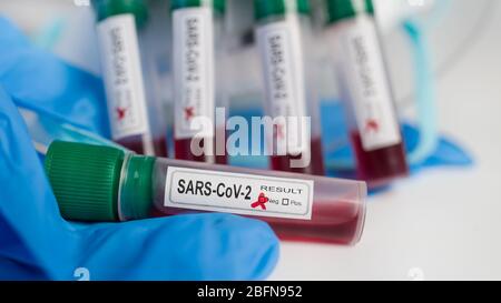 Negative SARS-CoV-2-Probe im Reagenzglas. Laborgeräte in COVID-19 Stillleben. Medizinische Blutprobe in Laborfläschchen, Schutzhandschuh, Gesichtsmaske. Stockfoto