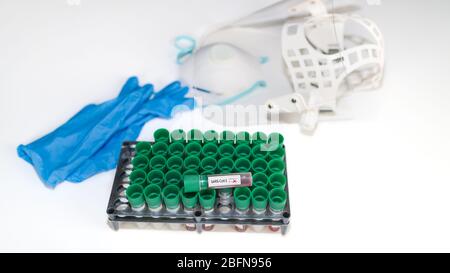 Reagenzgläser mit SARS-CoV-2 Blutproben in einem Rack. Diagnostisches Labor für Coronavirus. COVID-19. Plastikflaschen, blaue Handschuhe, Atemschutzmaske oder Gesichtsschutz. Stockfoto