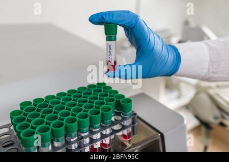 Hand in blauen Schutzhandschuh mit SARS-CoV-2-Reagenzglas. Infektiöse COVID-19-Pandemie. Labor mit automatischem Analysator und Blutproben im Rack. Stockfoto