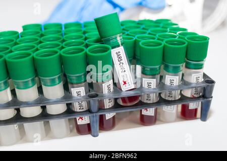 Coronavirus-Pandemie. Laborproben im Rack. Blutproben SARS-CoV-2. COVID-19 Testklinik. Sterile Viall-Kunststoffkappen und grüne Kappen. Globaler Ausbruch. Stockfoto