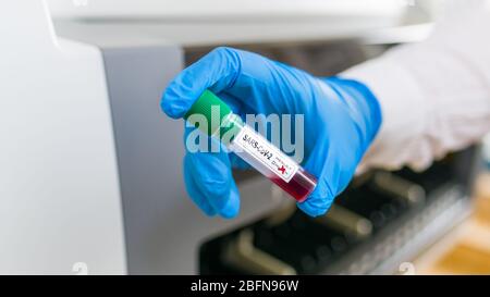 SARS-CoV-2 Blutprobe im Reagenzglas. Diagnostisches Labor für Coronavirus. Hand in blauen Schutzhandschuh, der Laborfläschchen mit COVID-19 positivem Ergebnis hält. Stockfoto