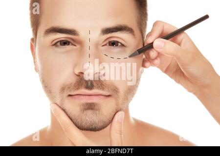 Chirurg zeichnet Zeichen auf männlichem Gesicht vor weißem Hintergrund. Konzept der plastischen Chirurgie Stockfoto