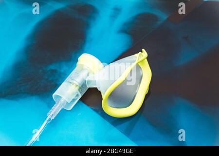 Sauerstoffmaske über den Röntgenfilmen der Brust. Covid-19 Ausbruch und Lungenentzündung. Stockfoto