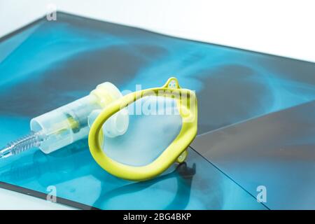 Sauerstoffmaske über den Röntgenfilmen der Brust. Covid-19 Ausbruch und Lungenentzündung. Stockfoto