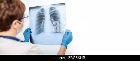 Eine Ärztin untersucht eine Röntgenaufnahme der Lunge eines Patienten, die mit dem Covid-19-Coronavirus, einer Lungenentzündung, infiziert ist. Röntgenstrahlen des Lichts. Fluorographie. Überprüfung der Lunge im Krankenhaus. Echte Röntgenaufnahmen der menschlichen Lunge. Stockfoto