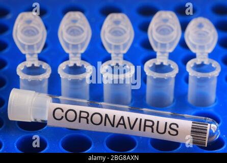 Testprotokoll mit CRISPR-Technologie zum Nachweis des Covid-19 SARS-Cov-2 neuartigen Coronavirus Stockfoto