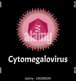 Cytamegalovirus-Struktur. Virusinfektion Zytomegalovirus. Sexuell übertragbare Krankheiten. Infografiken. Vektordarstellung auf isoliertem Hintergrund. Stock Vektor