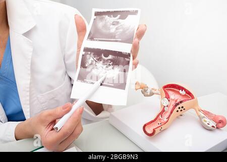 Nahaufnahme Ultraschall eines Eierstocken. Weibliche Gesundheit Untersuchung, Gynäkologie Stockfoto