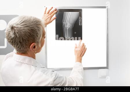 Reife Arzt beobachten ein Knie Röntgenbild auf einem Negatoskop. Radiologie Stockfoto
