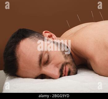 Mann Patient entspannt sich von Akupunktur Verfahren. Traditionelle chinesische Medizin. Akupunkturnadeln in Nahaufnahme auf braunem Hintergrund. Stockfoto