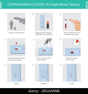 CORONAVIRUS Rapid Blood Testing. Die Methode für Test Kit CORONAVIRUS (COVID-19) bei Menschen mit Infektionsrisiko durch schnelle Ergebnisse verwendet. Stock Vektor