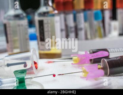 Aerobe und anaerobe Blutkulturproben in einem Krankenhaus, Spanien Stockfoto