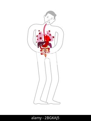 Innere Organe Coronavirus betroffen. Schmerzende Viren und Bakterien. Menschliche Krankheit. Coronavirus-Epidemie in der Welt. Ausbruch Covid-19 Pandemie. Welt-Dis Stock Vektor