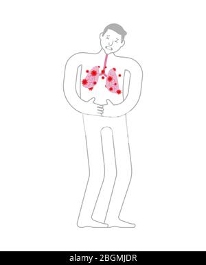 Coronavirus betroffenen Lunge. Erkranktes inneres Organ. Schmerzende Viren und Bakterien. Menschliche Krankheit. Coronavirus-Epidemie in der Welt. Ausbruch Covid-19 Pand Stock Vektor