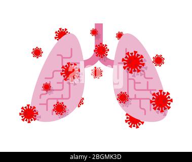 Coronavirus betroffenen Lunge. Erkranktes inneres Organ. Schmerzende Viren und Bakterien. Menschliche Krankheit. Coronavirus-Epidemie in der Welt. Ausbruch Covid-19 Pand Stock Vektor