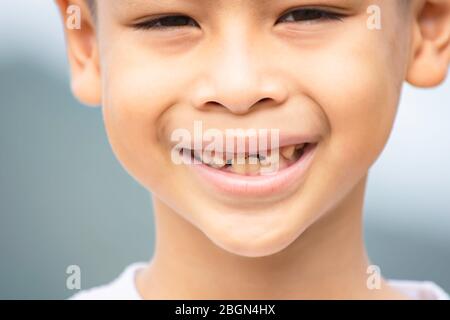 Baby Zähne sind gerade in den Mund fiel. Stockfoto