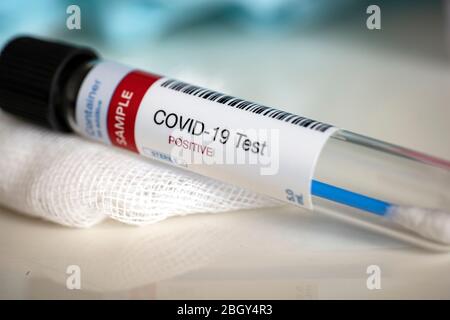 Prüfung auf Vorhandensein von Coronavirus. Röhrchen mit einer Tupfer-Probe, die positiv auf COVID-19 getestet wurde. Stockfoto