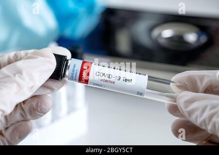 Prüfung auf Vorhandensein von Coronavirus. Röhrchen mit einem Tupfer für COVID-19. Stockfoto