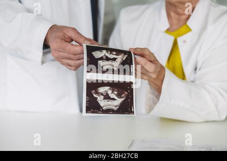 Zwei Ärzte halten Ultraschallbilder des Fötus Stockfoto