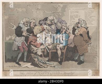 Amputation, 17. Februar 1786. Stockfoto