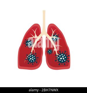 Viruszellen fressen Lunge. Viruszellen beißen Lunge. Beschädigte Lunge. Viruszelle mit gruseligen und bösen Gesicht. Coronavirus Essen Lungenkonzept. COVID-19. 2019-n Stock Vektor
