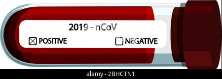 Flache Vektordarstellung des Coronavirus COVID-19-Reagenzglas mit positiven und negativen Häkchen. Röhrchen mit Blutprobe für COVID-19. Positiver Test für das neue schnell ausbreitende Coronavirus. Stock Vektor