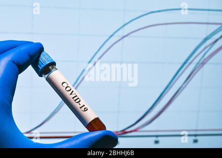 Real-Time PCR-Tests mit COVID-19. Ein Reagenzglas mit einer Probe auf dem Hintergrund von Amplifikationskurven. Stockfoto