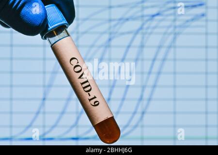 Real-Time PCR-Tests mit COVID-19. Ein Reagenzglas mit einer Probe auf dem Hintergrund von Amplifikationskurven. Stockfoto