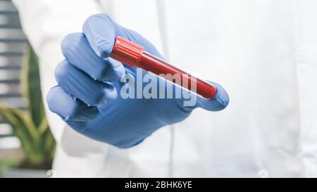 Arzt hält Blutprobenschlauch für die Prüfung in Schutzhandschuhen in einem Labor. Stockfoto