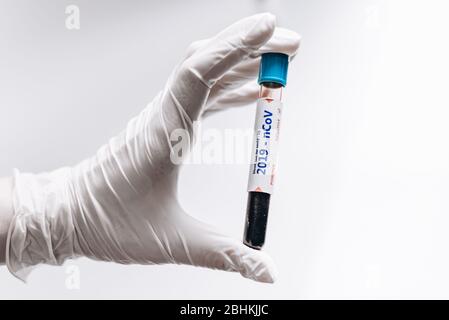 Negatives Bluttestergebnis für das neue schnell ausbreitende Coronavirus. Stockfoto