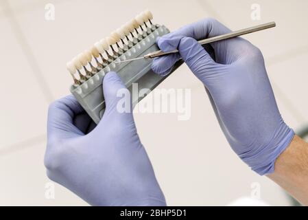 Zahnarzt Arzt in lila medizinischen Handschuhen Anwendung Probe von Zahnschmelz Skala lächelnde Frau Patienten Zähne, um den richtigen Schatten, Zähne Bleichen Verfahren zu holen. Nahaufnahme. Stockfoto