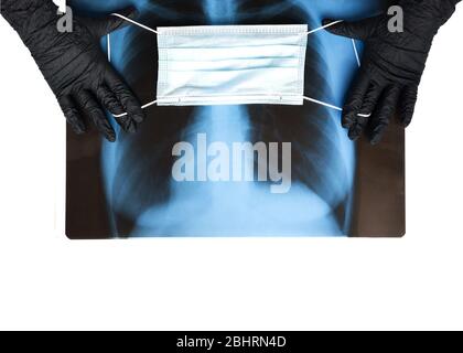 Blaue Atemmaske auf Röntgenaufnahmen der menschlichen Lunge in Händen in schwarzen Handschuhen, Nahaufnahme. Coronavirus Covid-19-Krankheit-Konzept. Pandemieversicherung, Luftgetragene D Stockfoto