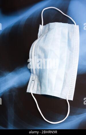 Blaue Atemmaske auf Röntgenaufnahmen der menschlichen Lunge, Nahaufnahme. Coronavirus Covid-19-Krankheit-Konzept. Stockfoto