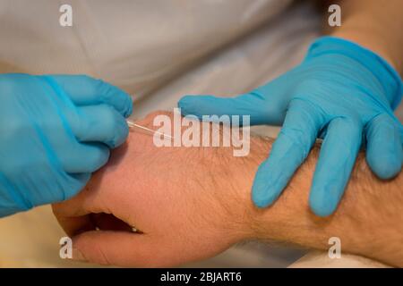 Ein Mediziner, der eine Kanüle in die Hand eines Patienten einführen soll. Stockfoto