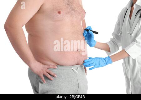 Ärztin, die Marken auf Bauch des dicken Mannes auf weißem Hintergrund. Gewichtsverlust Chirurgie Konzept Stockfoto