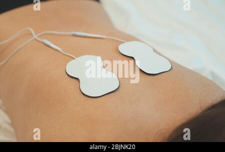 Frauenkörper mit Elektroden auf dem Rücken. Elektrische Muskelstimulation. Stockfoto