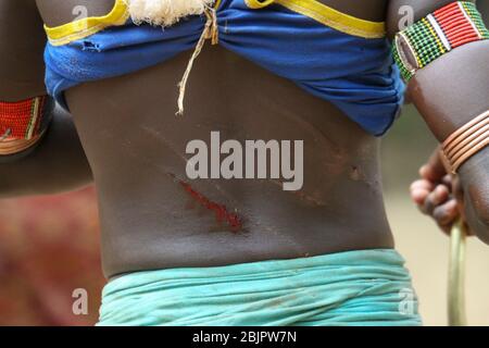 Die rohen Narben auf dem Rücken einer Hamar-Frau, nachdem sie bei einer Zeremonie zum "Springen des Stiers" gepeitscht wurde. Fotografiert im Omo River Valley, Äthiopien Stockfoto
