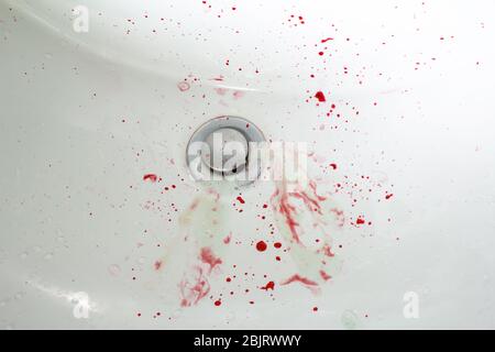 Blut in der Spüle und Zahnpasta bluten Gummi Kopie Raum. Nahaufnahme Stockfoto