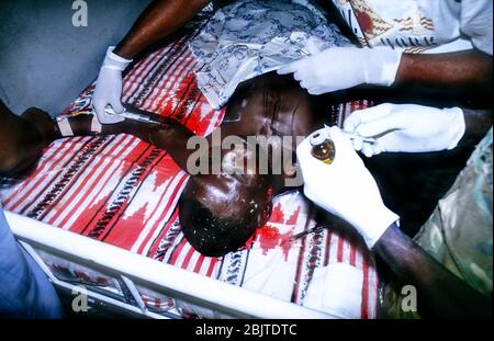 Schwer verwundeter SPLA-Soldat, der wegen Kriegsverletzungen im Südsudan, Afrika, behandelt wurde Stockfoto