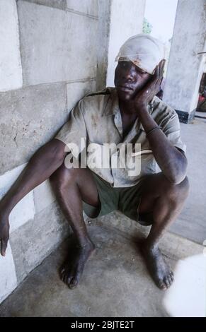 Ein verletzte Soldat der Volksbefreiungsarmee des Sudan in einem Dorf in der Nähe von Yei, Republik Südsudan Stockfoto