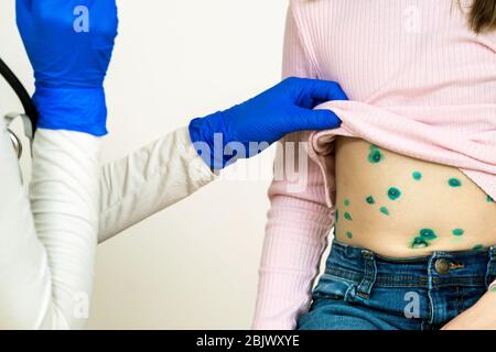 Arzt untersucht ein Kind mit grünen Ausschlägen bedeckt auf Magen krank mit Windpocken, Masern oder Röteln Virus. Stockfoto