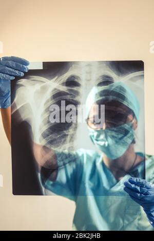 Konzeptuelles Bild eines Arztes, der eine Röntgenaufnahme einiger Lungen hält und analysiert. Stockfoto