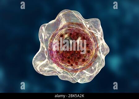 Balamuthia mandrillaris amoeba, Computerdarstellung. Dies ist die infektiöse Form des Organismus, die Zyste. B. mandrillaris, ein freilebender einzelliger Organismus, kommt in Wasser und Boden in gemäßigten Regionen vor. Infektionen sind selten, aber es kann die Krankheit granulomatöse amöbische Enzephalitis (GAE) des Gehirns verursachen, mit ist fast immer tödlich. Stockfoto