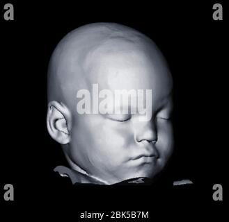 Bild des Kopfes des Babys, Computertomographie (CT) Scan. Stockfoto