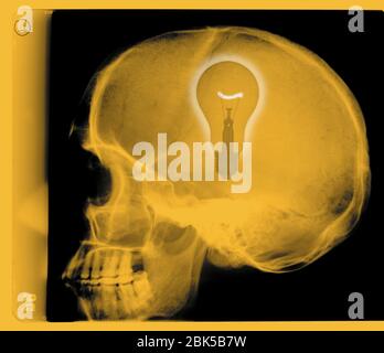 Menschlicher Schädel mit Glühbirne, farbiger Röntgenstrahl. Stockfoto