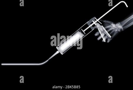 Dichtmittelpistole, Röntgen. Stockfoto