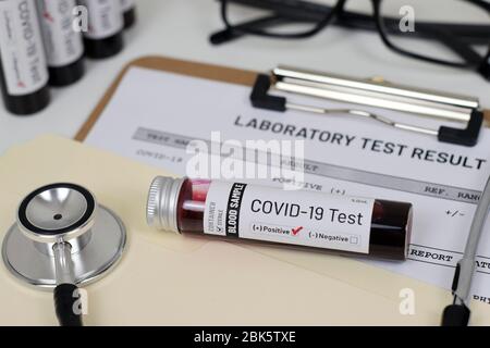 Covid-19 (Coronavirus) Testergebnis Mock-up / Konzept illustratives Bild mit Fläschchen und Ausdruck. Stockfoto