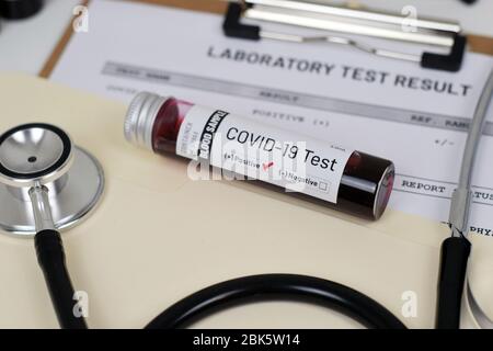 Covid-19 (Coronavirus) Testergebnis Mock-up / Konzept illustratives Bild mit Fläschchen und Ausdruck. Stockfoto