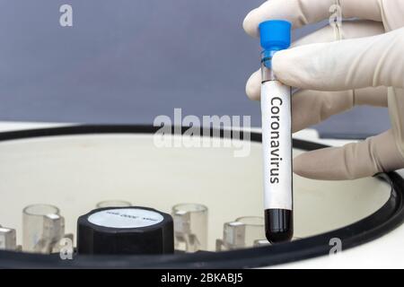 Erforschung von Viren in Zentrifugenmaschinen im Labor. Hand in Handschuh hält ein Reagenzglas mit der Aufschrift Coronavirus. Kontrolle der Probe mit Blut i Stockfoto